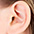 Plastické operace uší